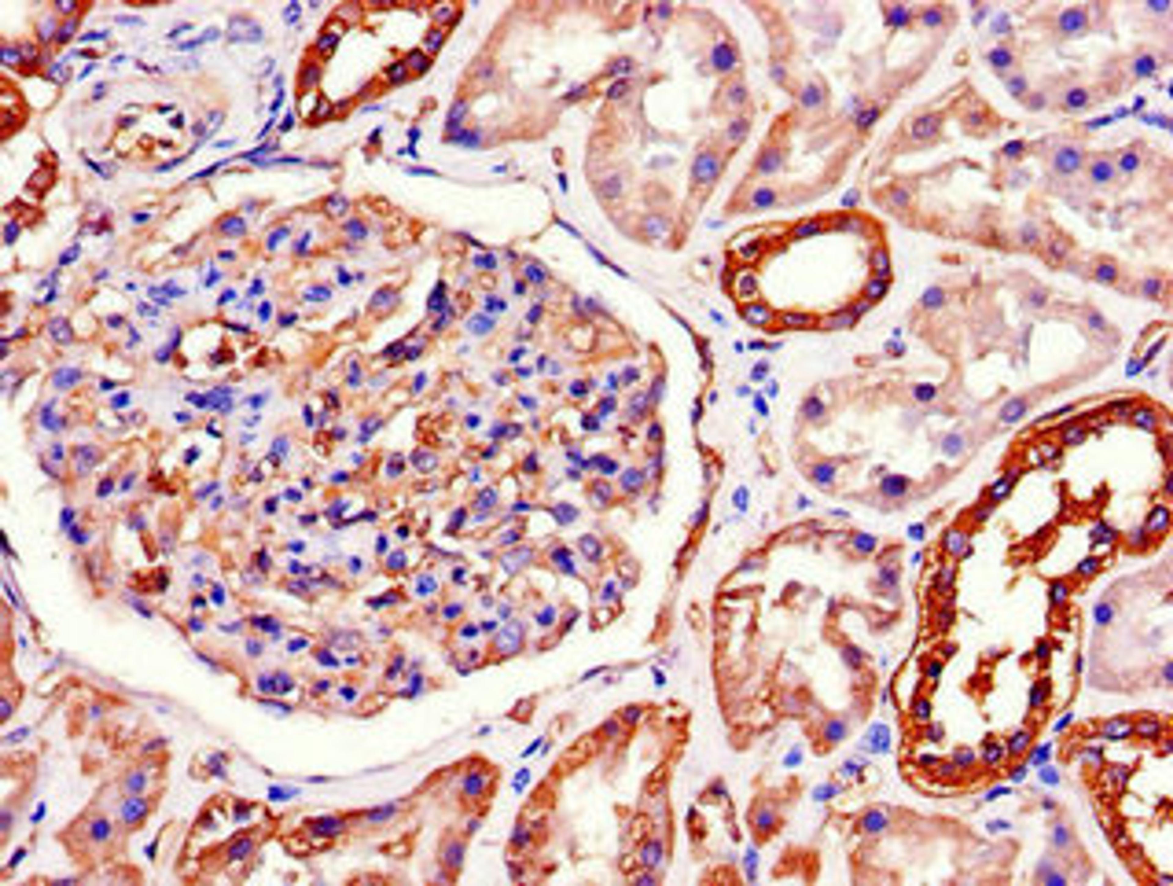 Immunohistochemistry of paraffin-embedded human kidney tissue using CSB-PA18129A0Rb at dilution of 1:100