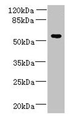 Western blot. All lanes: ADAT1 antibody at 6µg/ml + MDA-MB-231 whole cell lysate. Secondary. Goat polyclonal to rabbit IgG at 1/10000 dilution. Predicted band size: 56, 39 kDa. Observed band size: 56 kDa