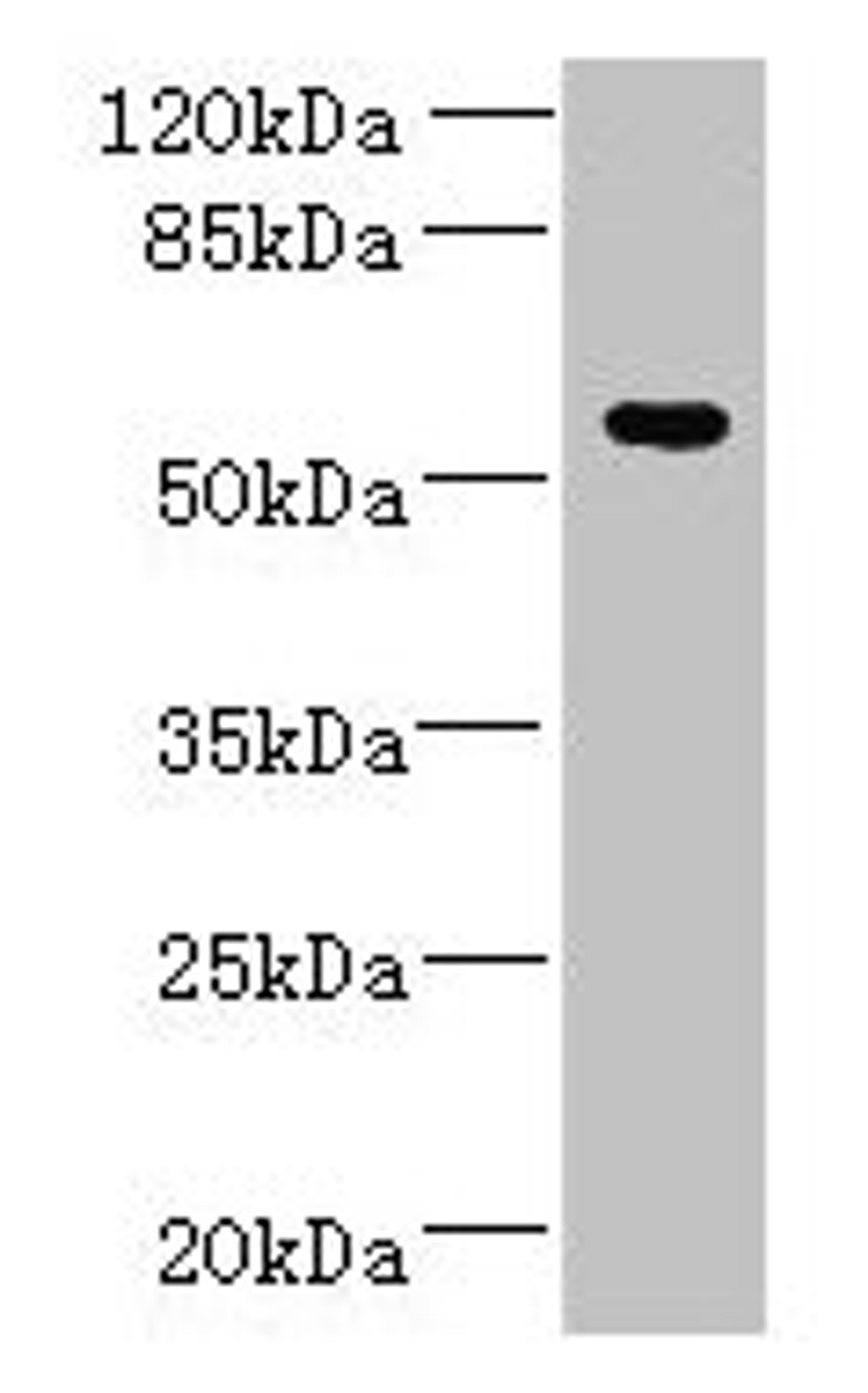 Western blot. All lanes: ADAT1 antibody at 6µg/ml + MDA-MB-231 whole cell lysate. Secondary. Goat polyclonal to rabbit IgG at 1/10000 dilution. Predicted band size: 56, 39 kDa. Observed band size: 56 kDa