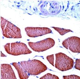 Immunohistochemistry-Paraffin: Actin Alpha 1 Skeletal Muscle Antibody [NBP1-35265] - Human Skeletal Muscle.