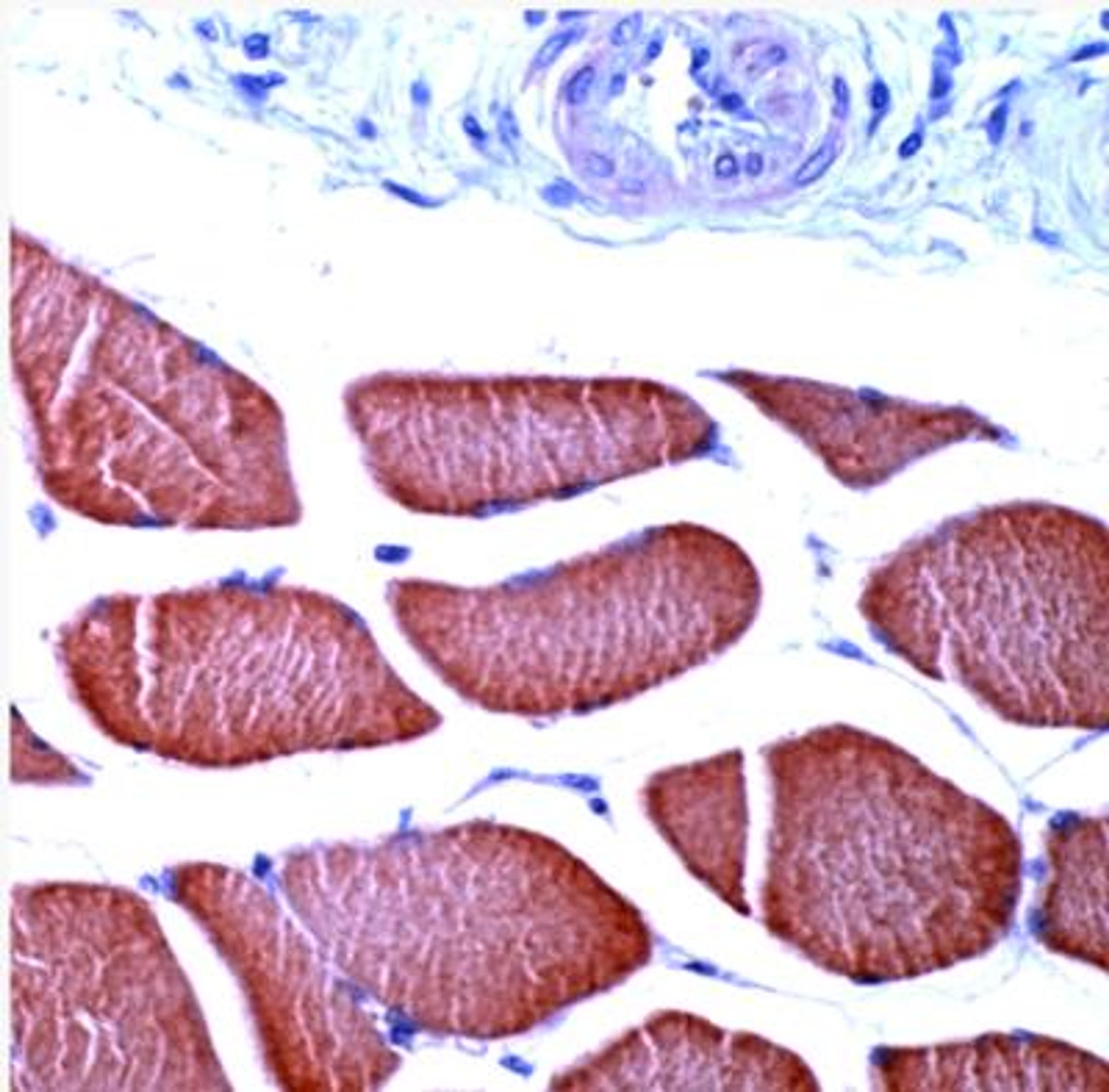 Immunohistochemistry-Paraffin: Actin Alpha 1 Skeletal Muscle Antibody [NBP1-35265] - Human Skeletal Muscle.