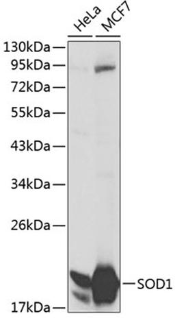 Western blot - SOD1 antibody (A0274)