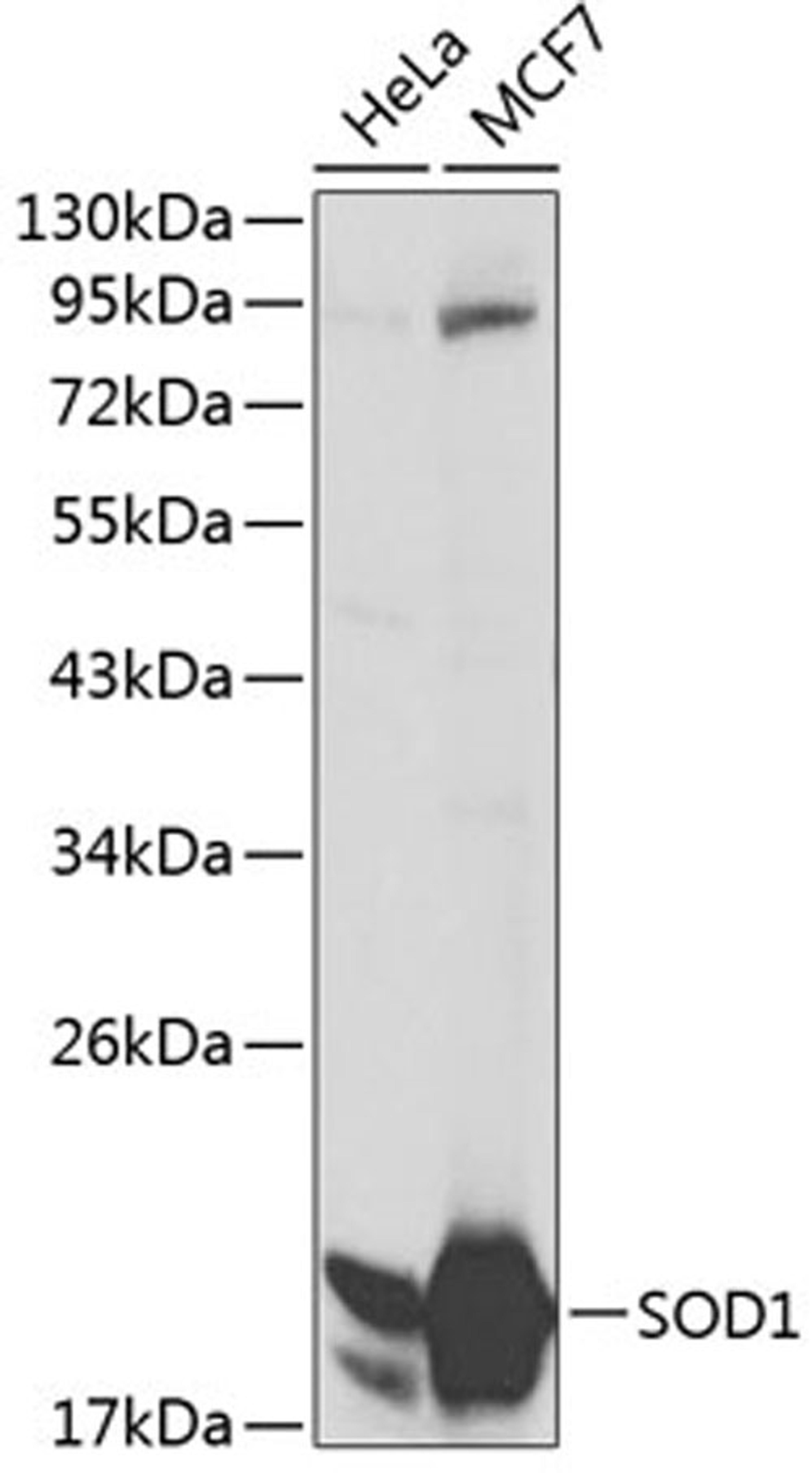 Western blot - SOD1 antibody (A0274)