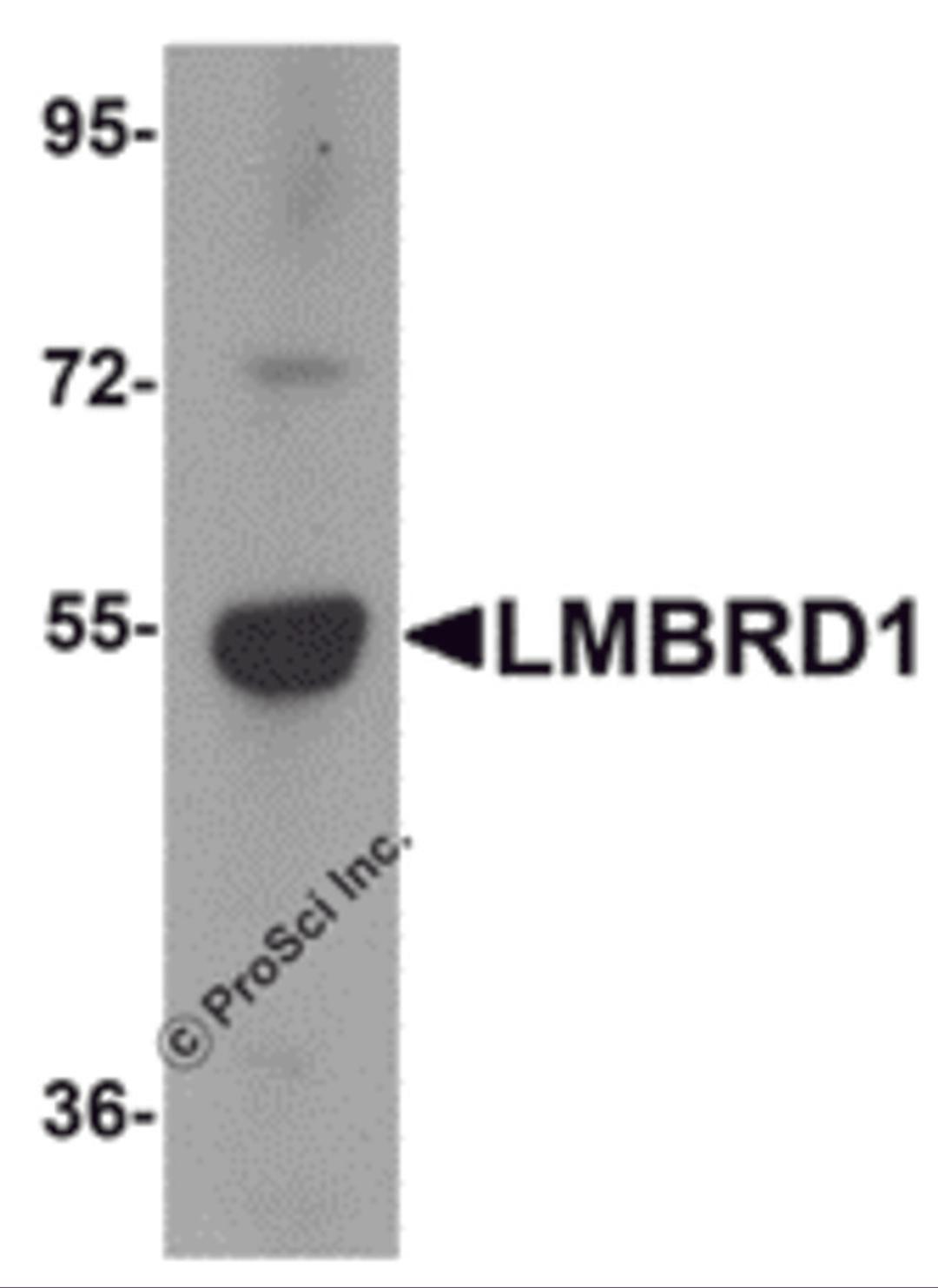 Western blot analysis of LMBRD1 in human brain tissue lysate with LMBRD1 antibody at 1 μg/mL.