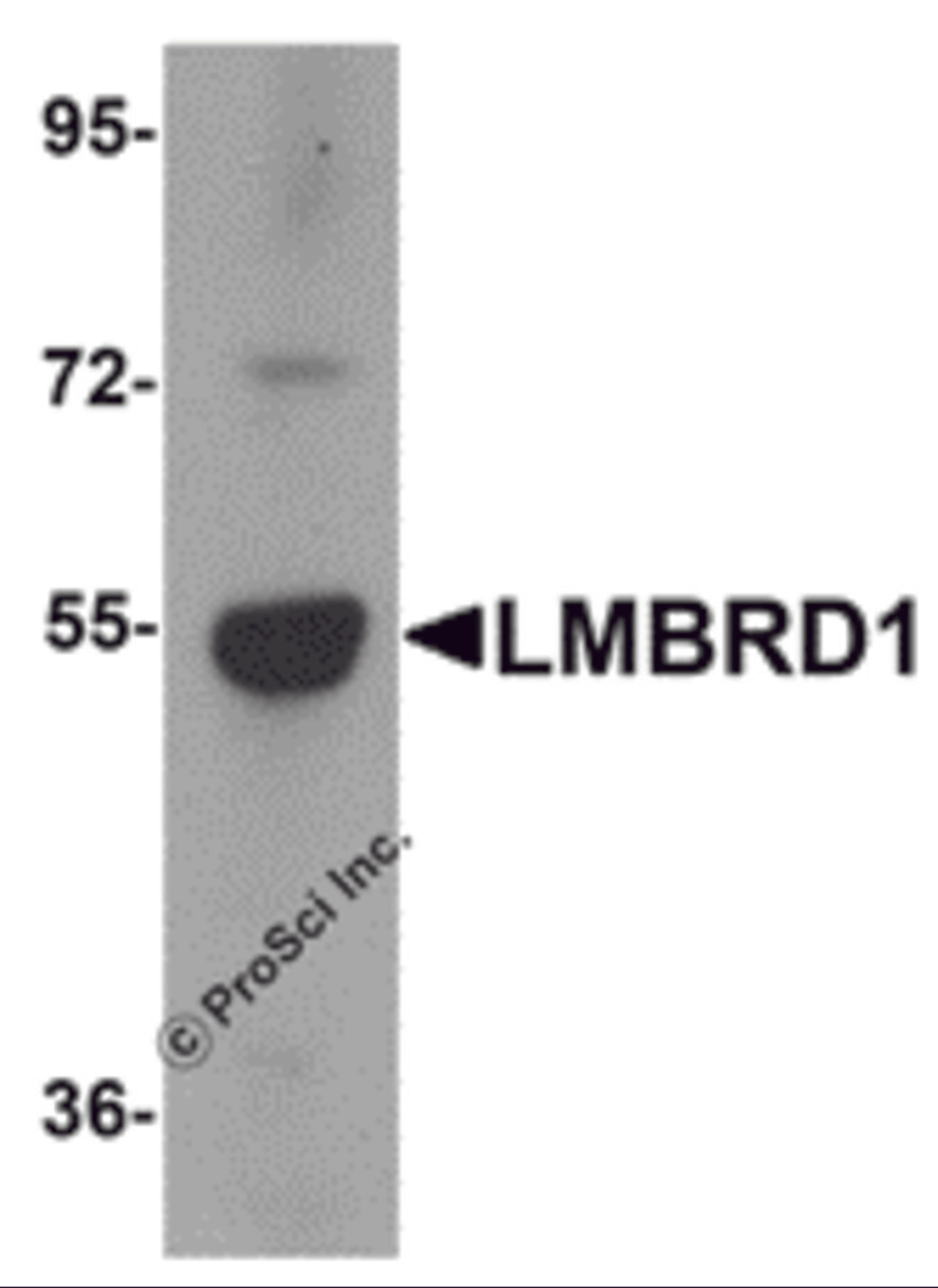 Western blot analysis of LMBRD1 in human brain tissue lysate with LMBRD1 antibody at 1 μg/mL.