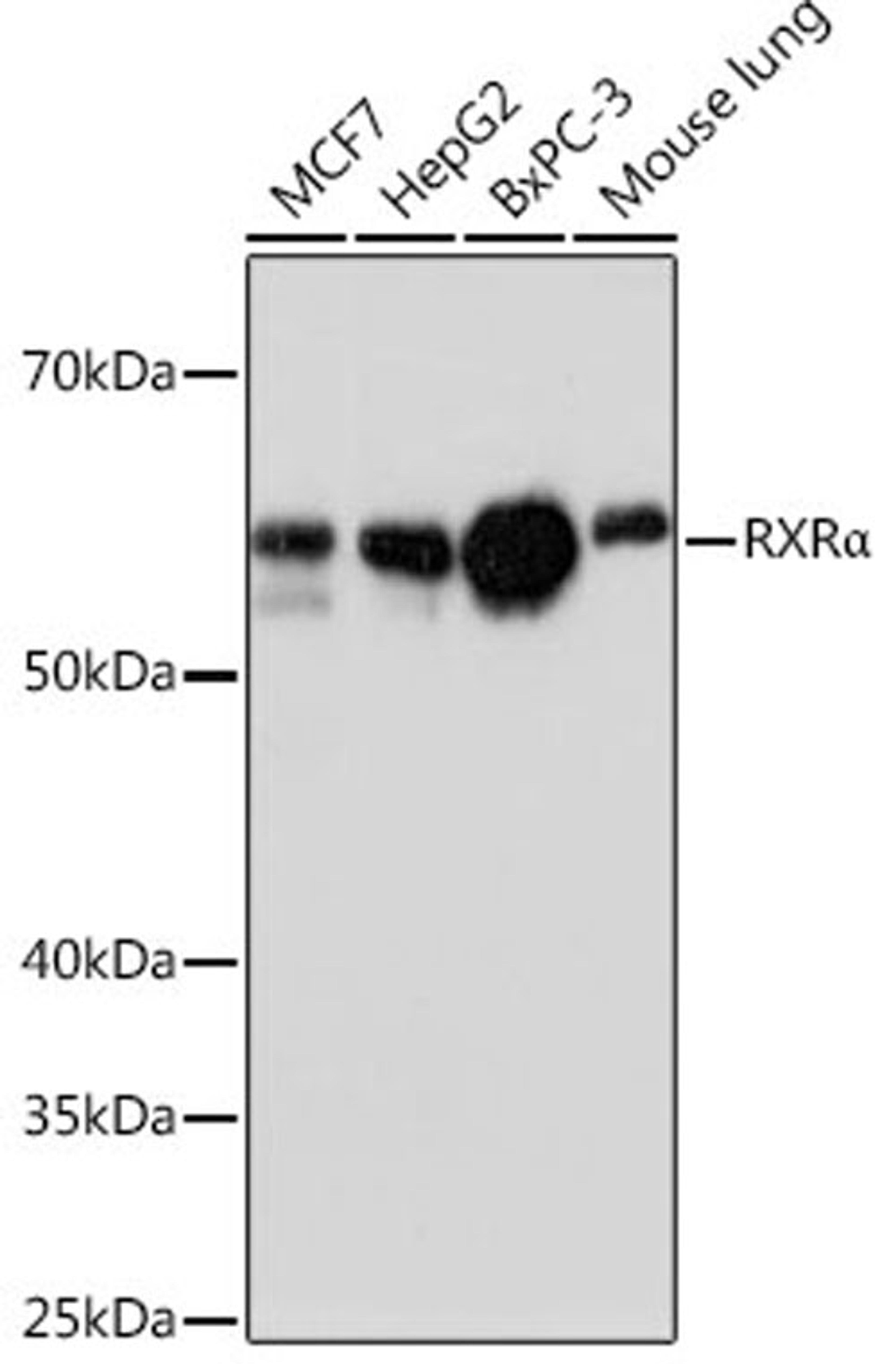 Western blot - RXRa antibody (A19105)