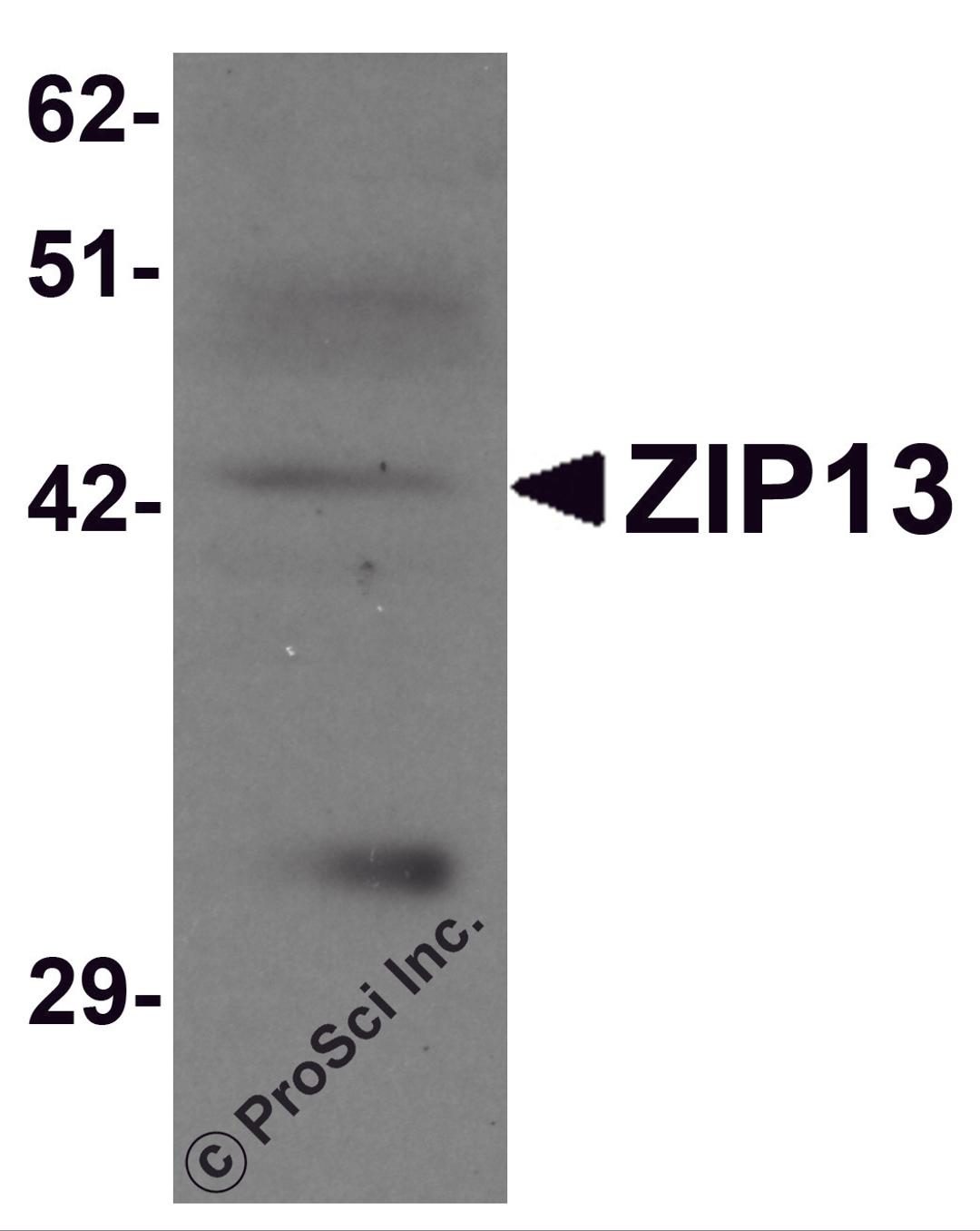 Western blot analysis of ZIP13 in K562 cell lysate with ZIP13 antibody at 1 &#956;g/mL.