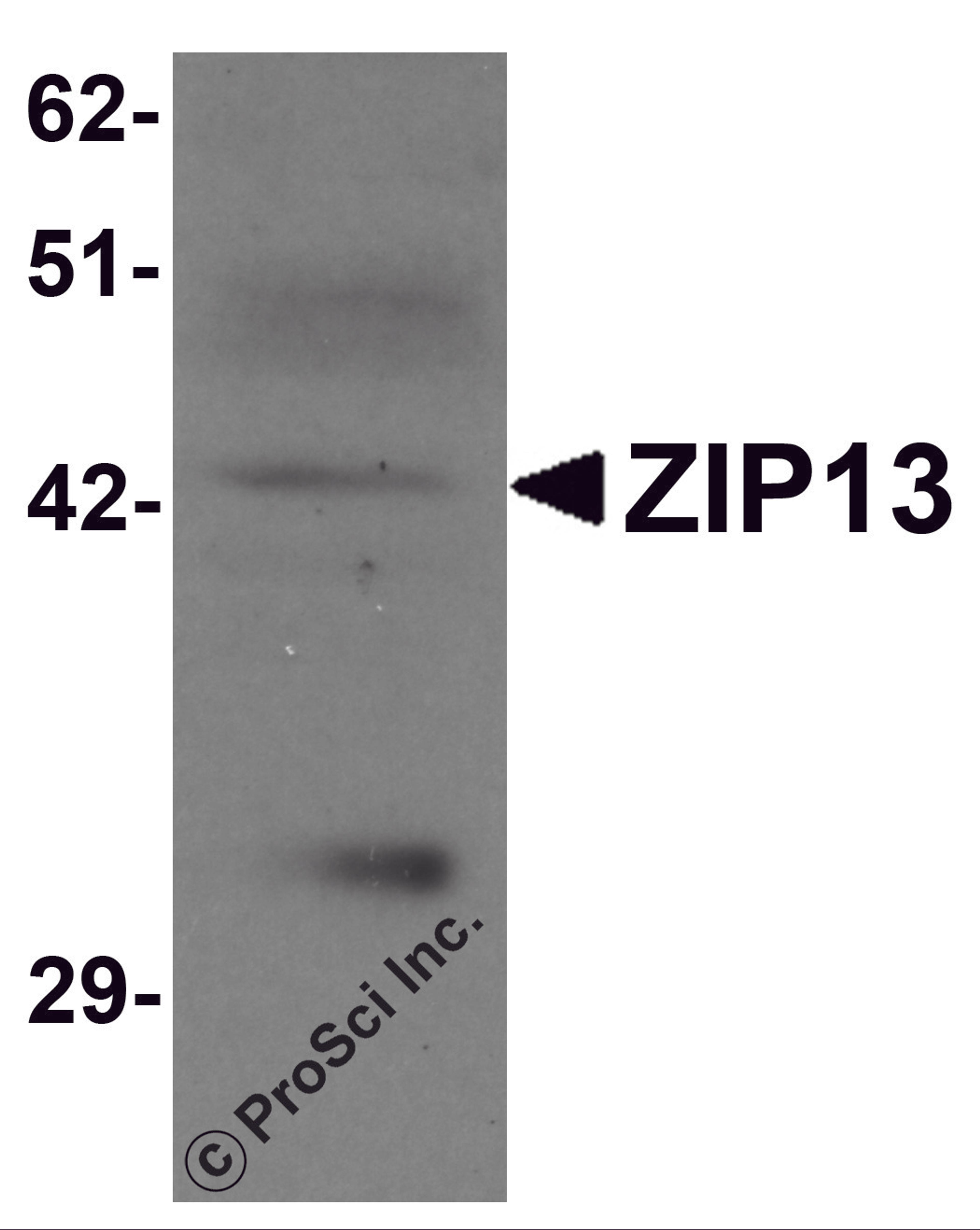 Western blot analysis of ZIP13 in K562 cell lysate with ZIP13 antibody at 1 μg/mL.