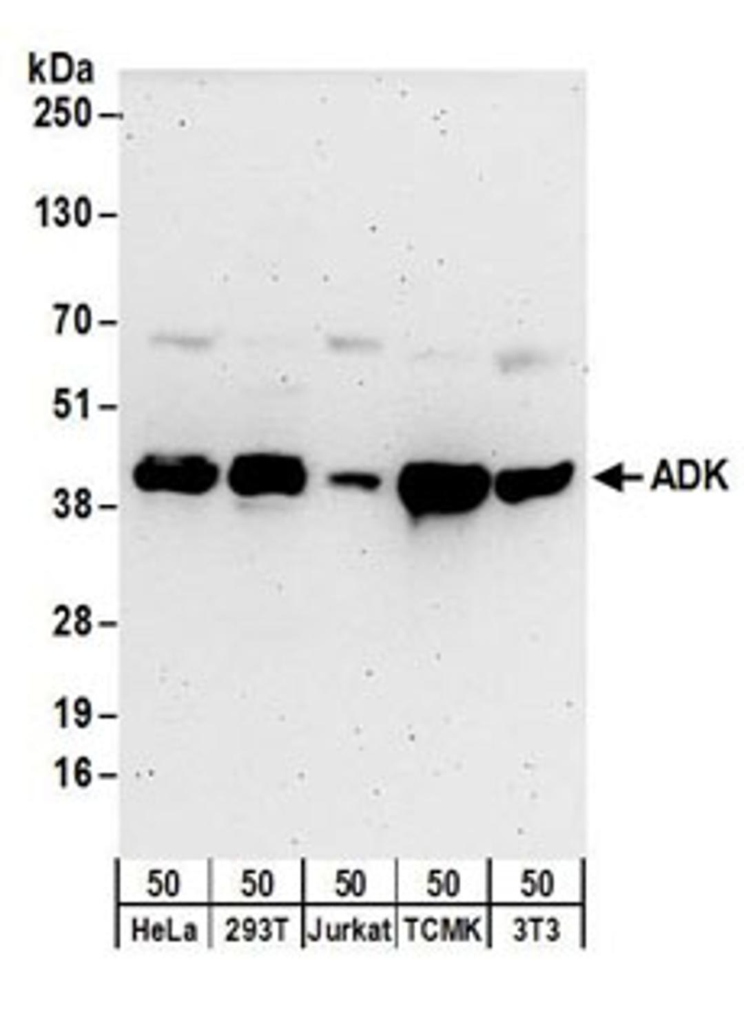 Detection of human and mouse ADK by western blot.