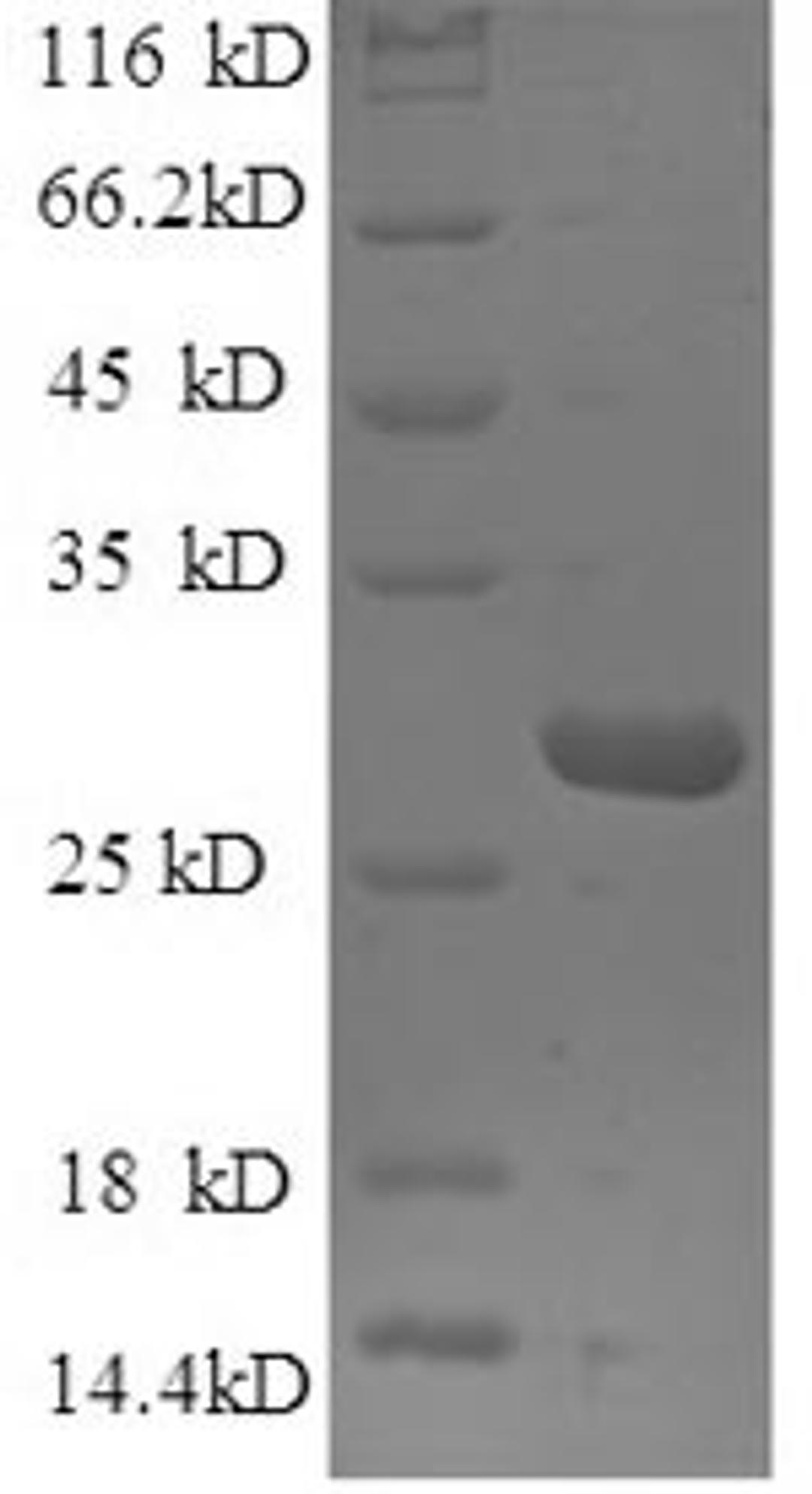 (Tris-Glycine gel) Discontinuous SDS-PAGE (reduced) with 5% enrichment gel and 15% separation gel.