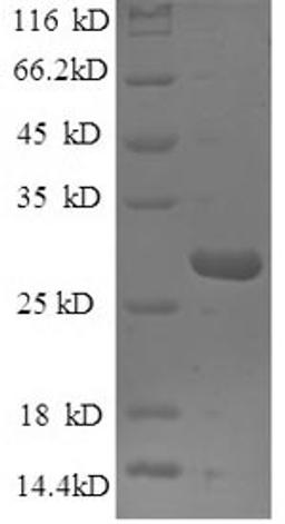 (Tris-Glycine gel) Discontinuous SDS-PAGE (reduced) with 5% enrichment gel and 15% separation gel.