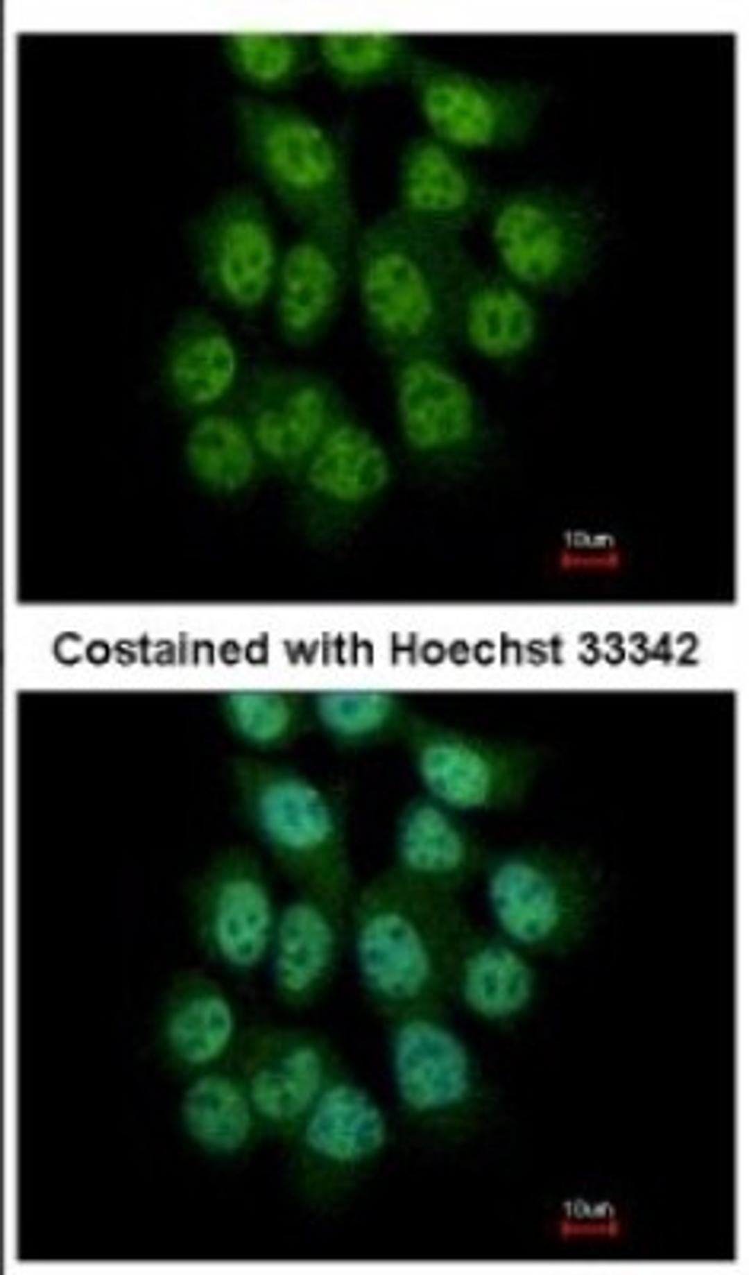 Immunocytochemistry/Immunofluorescence: CREB3L3 Antibody [NBP2-16008] - Immunofluorescence analysis of paraformaldehyde-fixed A431, using antibody at 1:500 dilution.