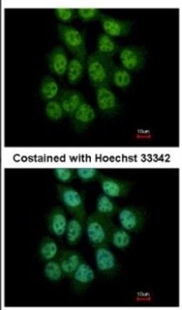 Immunocytochemistry/Immunofluorescence: CREB3L3 Antibody [NBP2-16008] - Immunofluorescence analysis of paraformaldehyde-fixed A431, using antibody at 1:500 dilution.