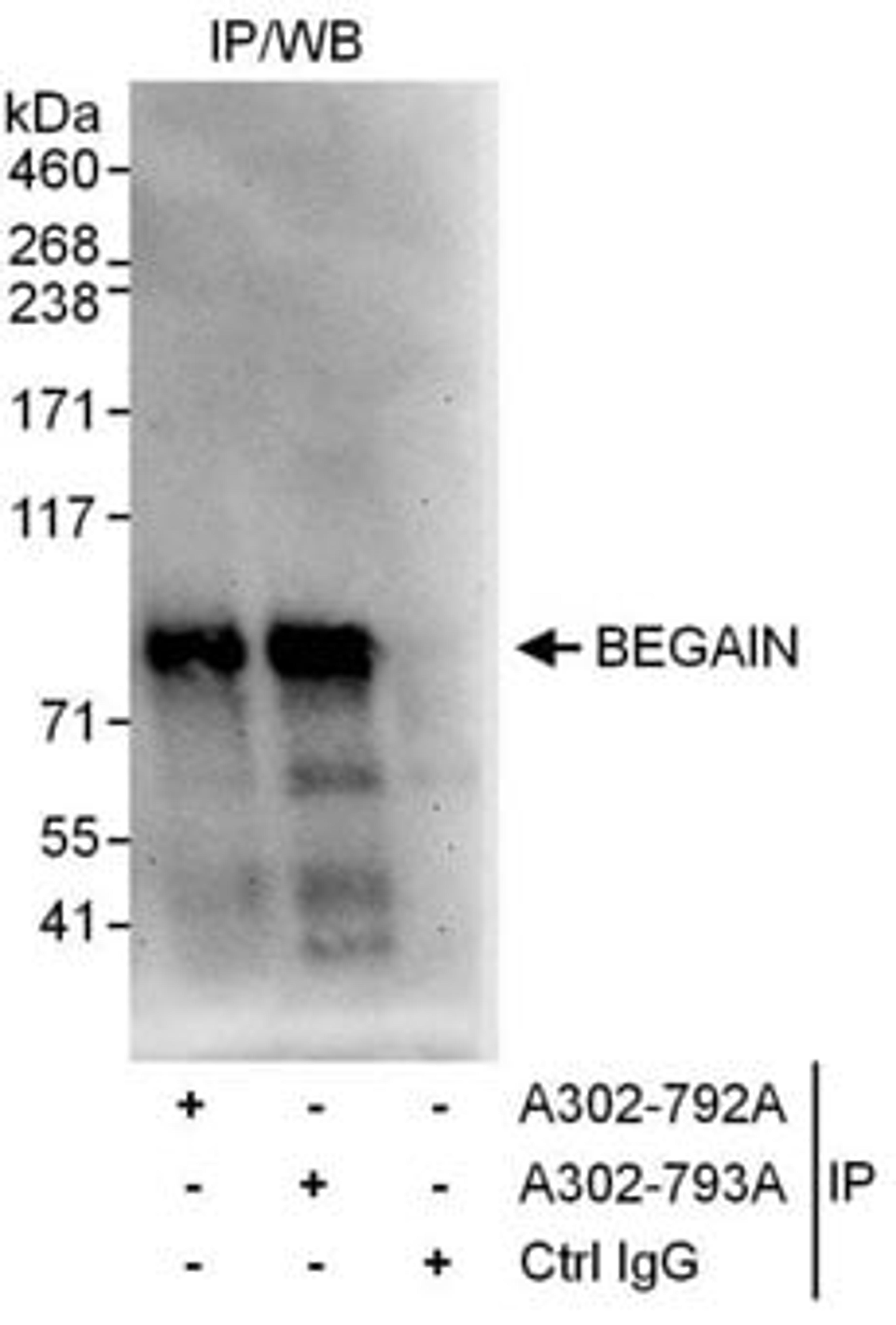 Detection of human BEGAIN by western blot of immunoprecipitates.