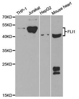 Western blot analysis of extracts of various cell lines using FLI1 antibody