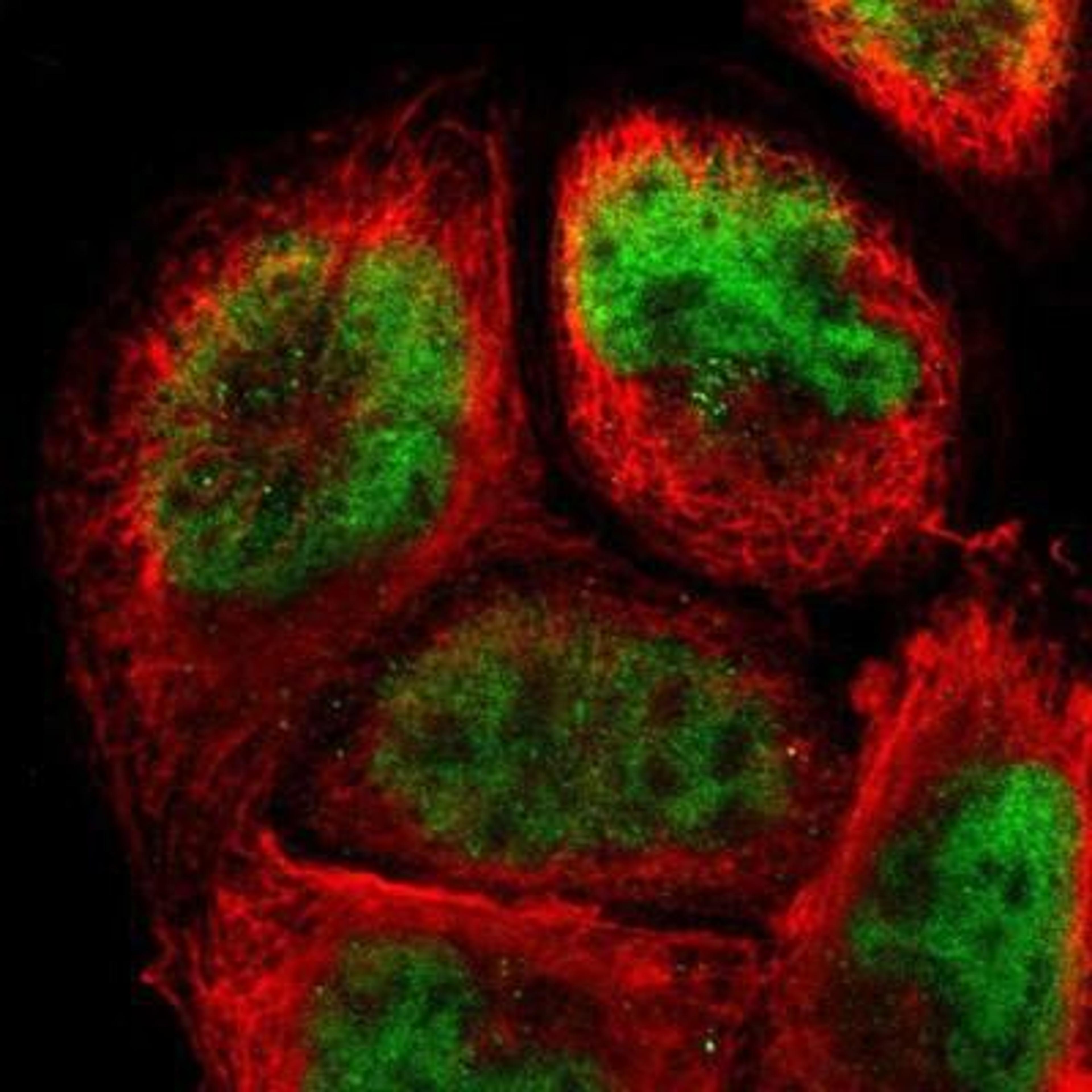 Immunocytochemistry/Immunofluorescence: ZFX Antibody [NBP1-80582] - Staining of human cell line A-431 shows positivity in nucleus but not nucleoli.