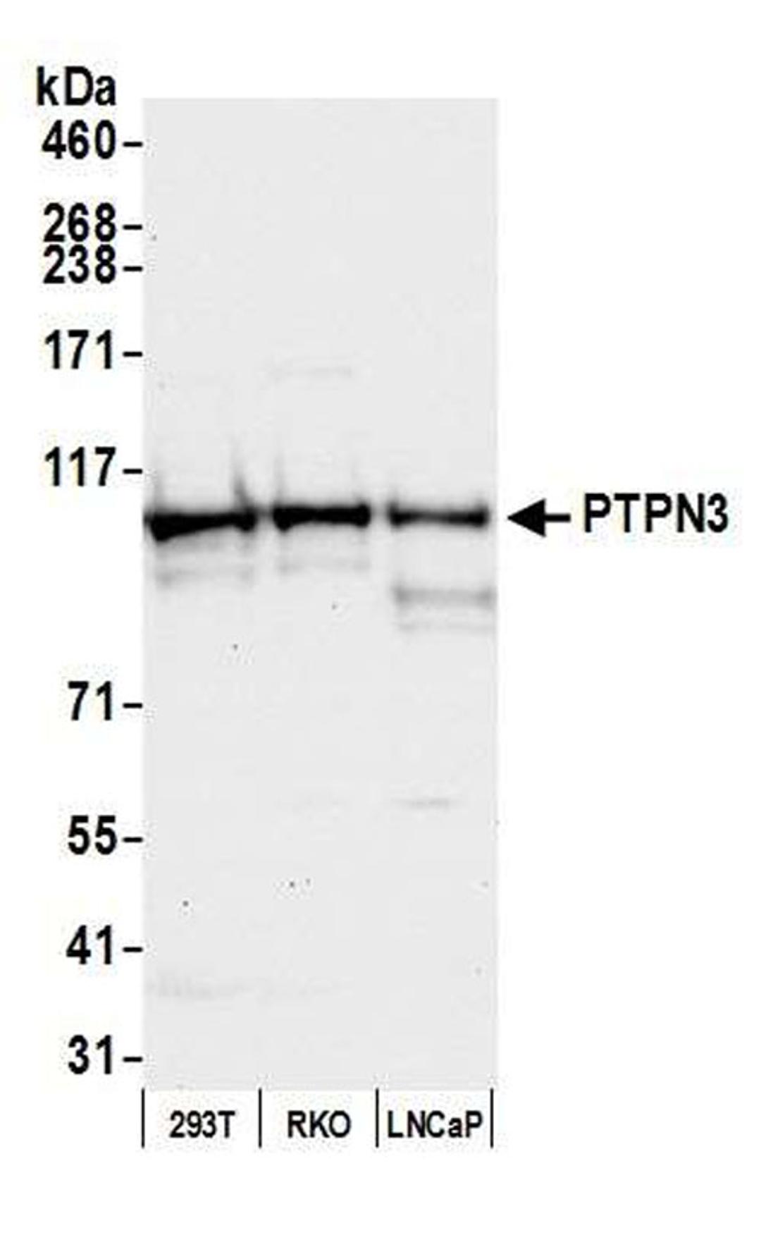 Detection of human PTPN3 by WB.