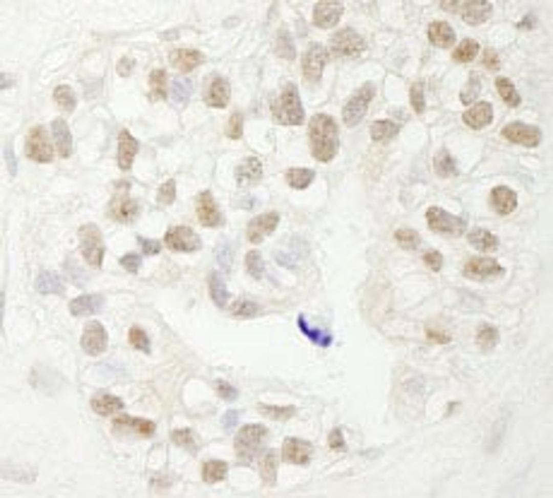 Detection of human FBW7 by immunohistochemistry.