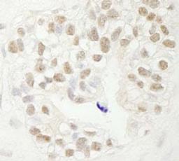 Detection of human FBW7 by immunohistochemistry.