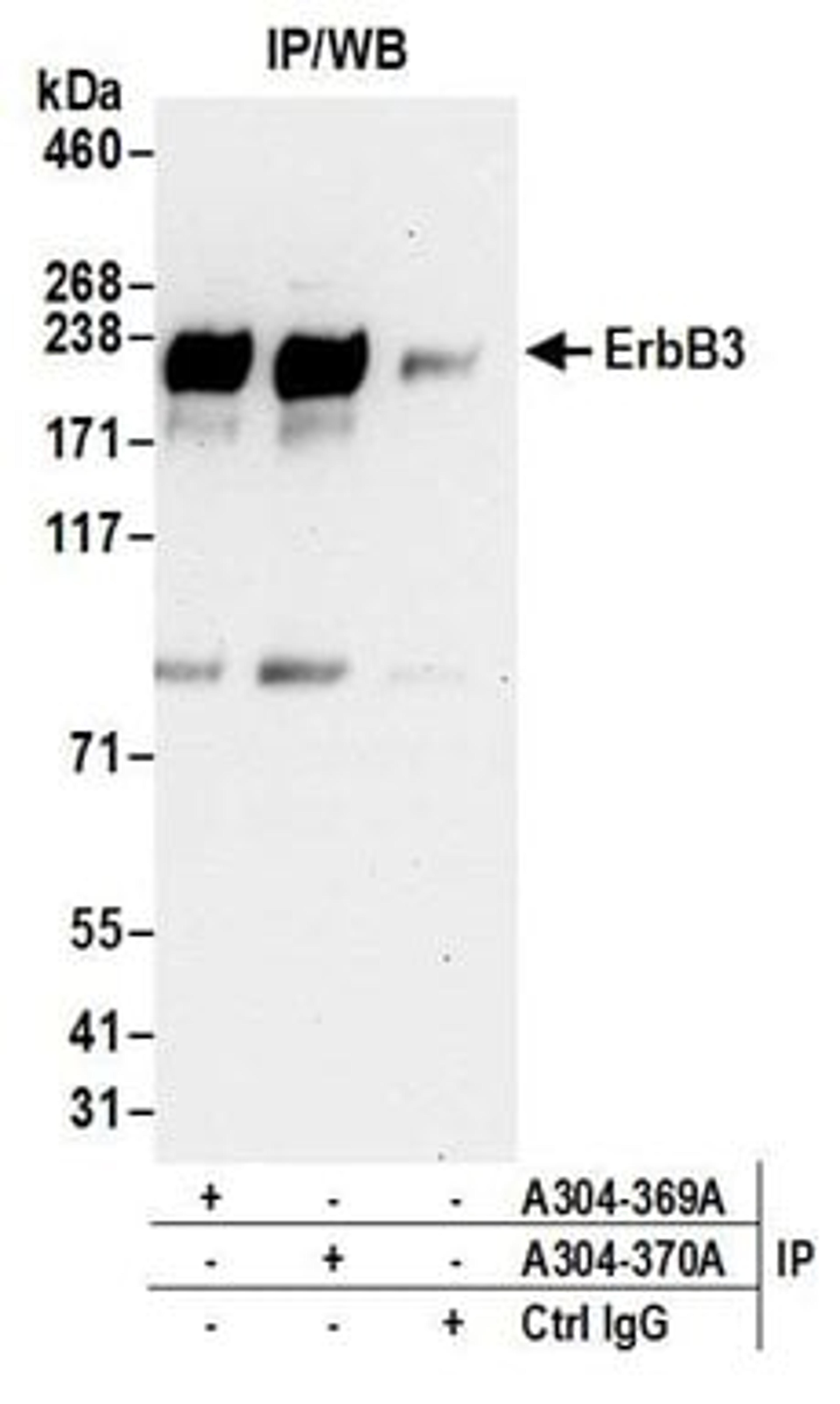 Detection of human ErbB3 by western blot of immunoprecipitates.