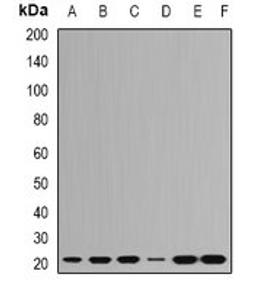 Western blot analysis of Hela (Lane1), HepG2 (Lane2), SHSY5Y (Lane3), Jurkat (Lane4), mouse brain (Lane5), mouse spleen (Lane6) whole cell lysates using RPL9 antibody