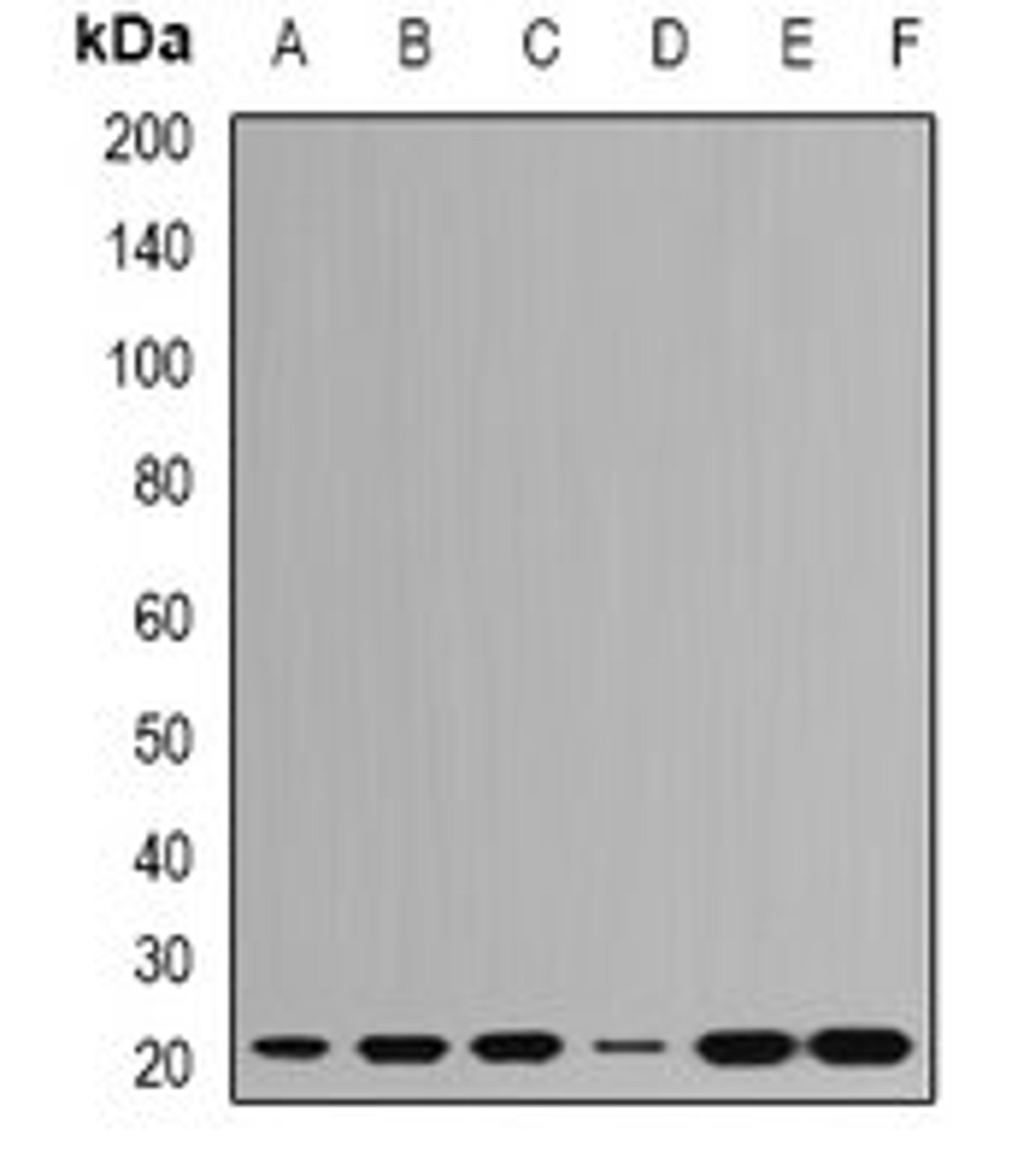 Western blot analysis of Hela (Lane1), HepG2 (Lane2), SHSY5Y (Lane3), Jurkat (Lane4), mouse brain (Lane5), mouse spleen (Lane6) whole cell lysates using RPL9 antibody