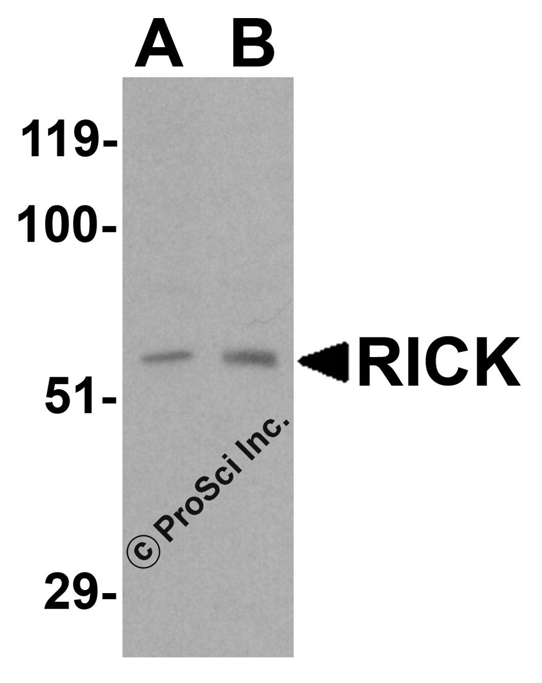 Western blot analysis of RICK in (A) 3T3 and (B) K562 cell lysate with RICK antibody at 0.5 &#956;g/mL