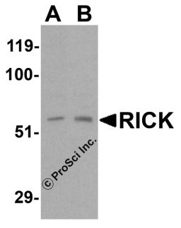 Western blot analysis of RICK in (A) 3T3 and (B) K562 cell lysate with RICK antibody at 0.5 &#956;g/mL