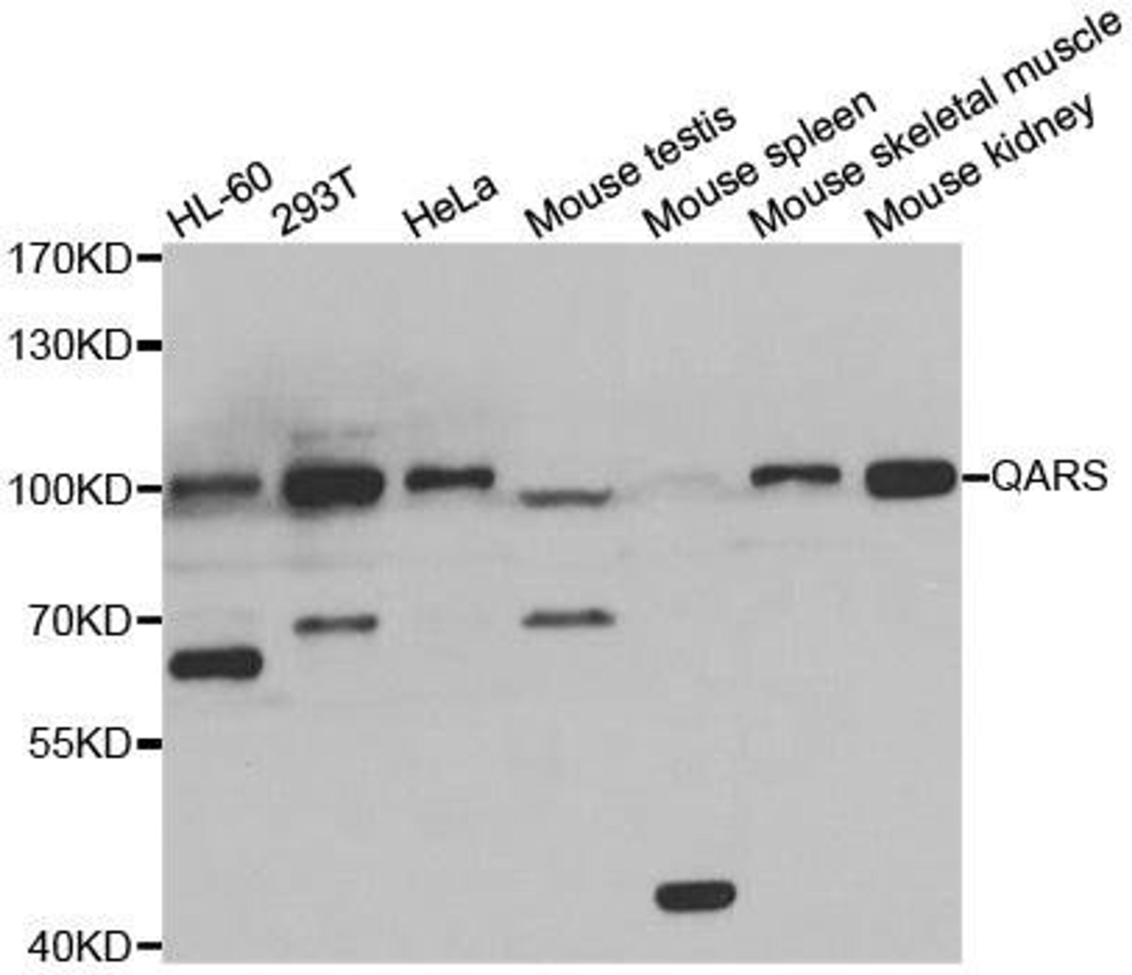 Western blot analysis of extracts of various cell lines using QARS antibody