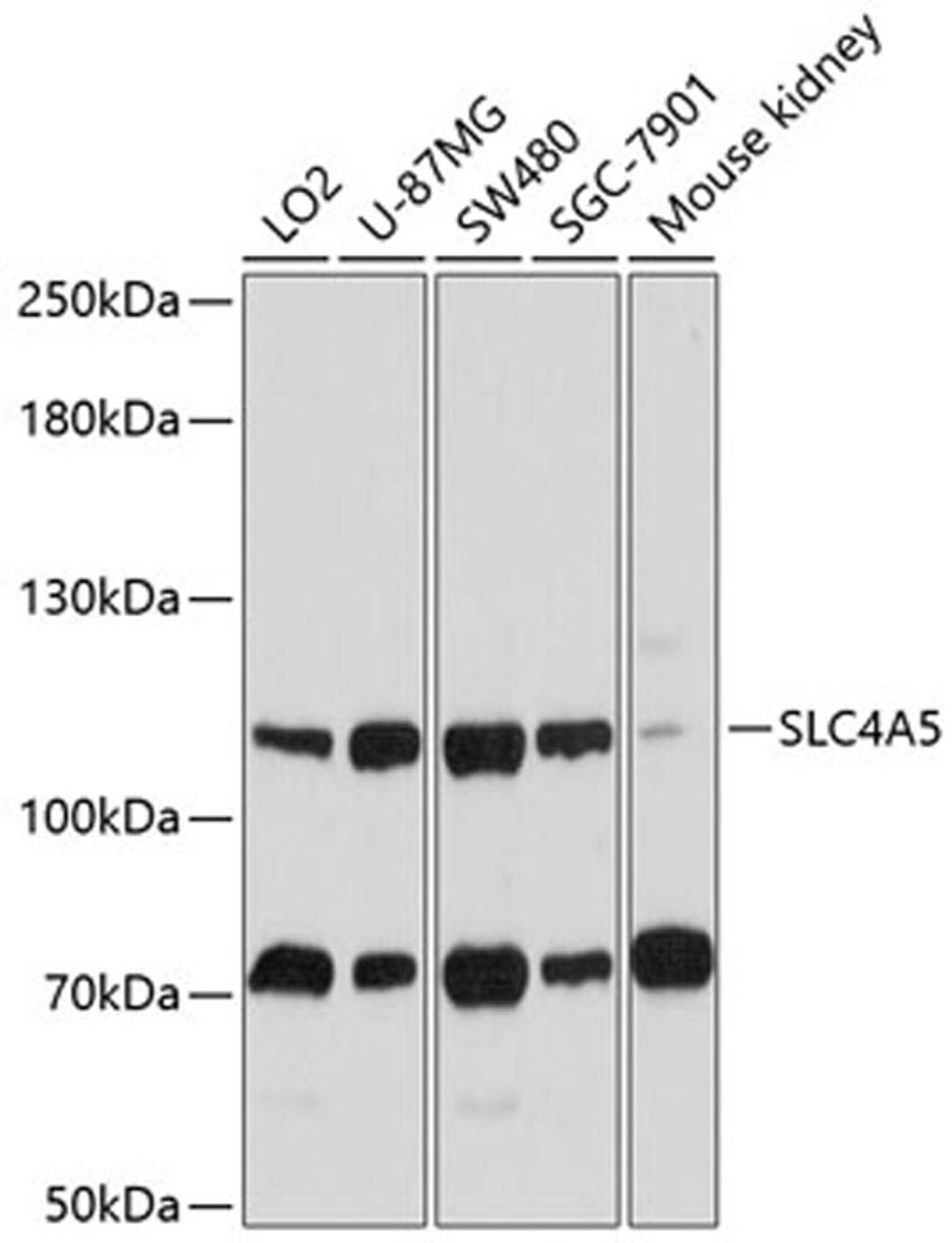 Western blot - SLC4A5 antibody (A10436)