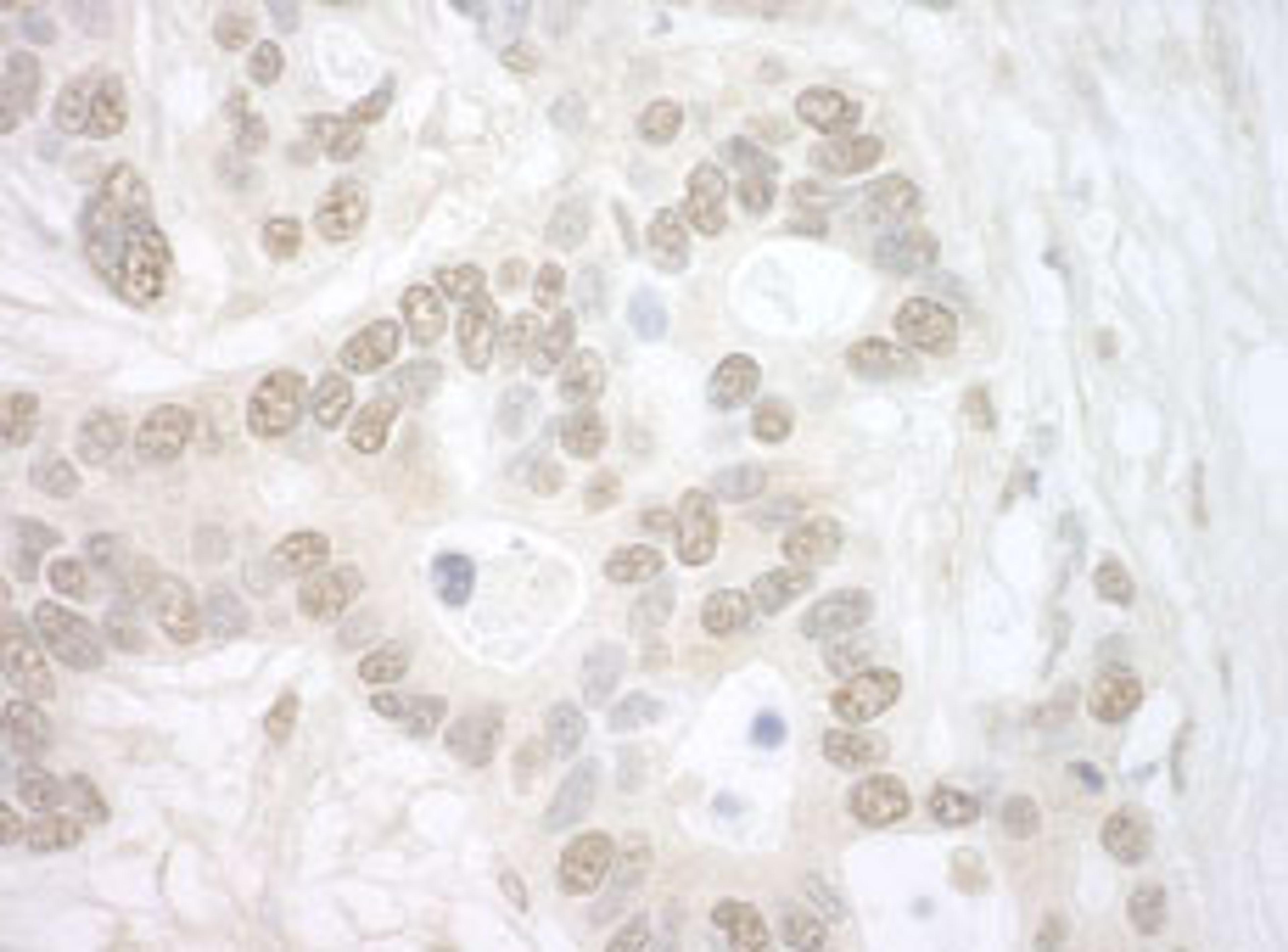 Detection of human Importin 4 by immunohistochemistry.