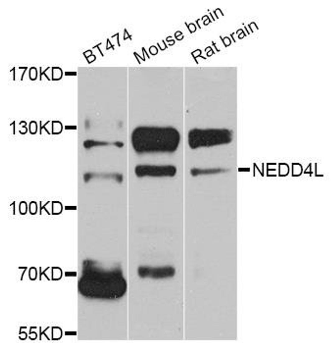 Western blot analysis of extracts of various cell lines using NEDD4L antibody