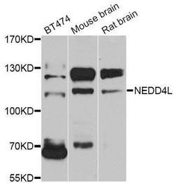 Western blot analysis of extracts of various cell lines using NEDD4L antibody