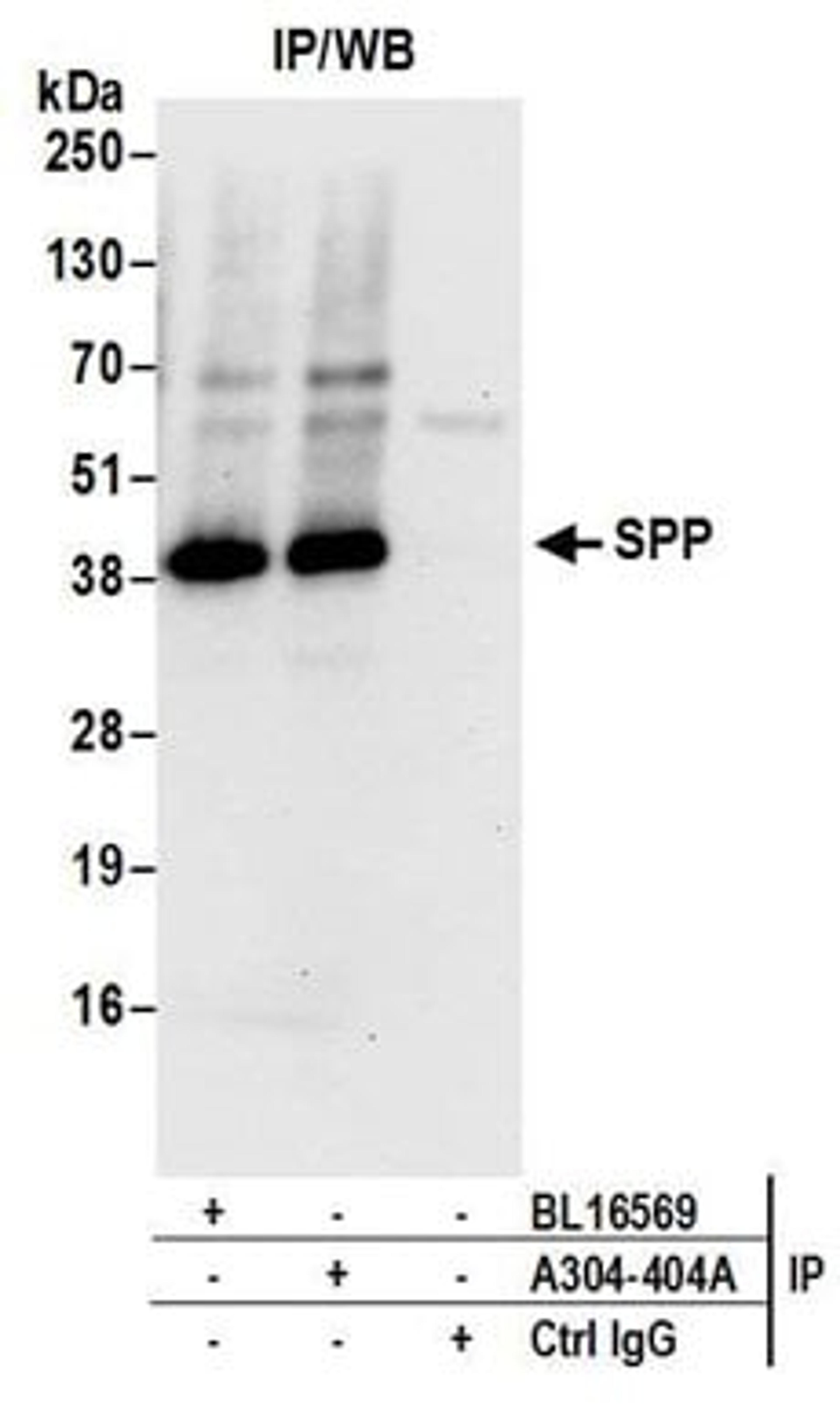 Detection of human SPP by western blot of immunoprecipitates.