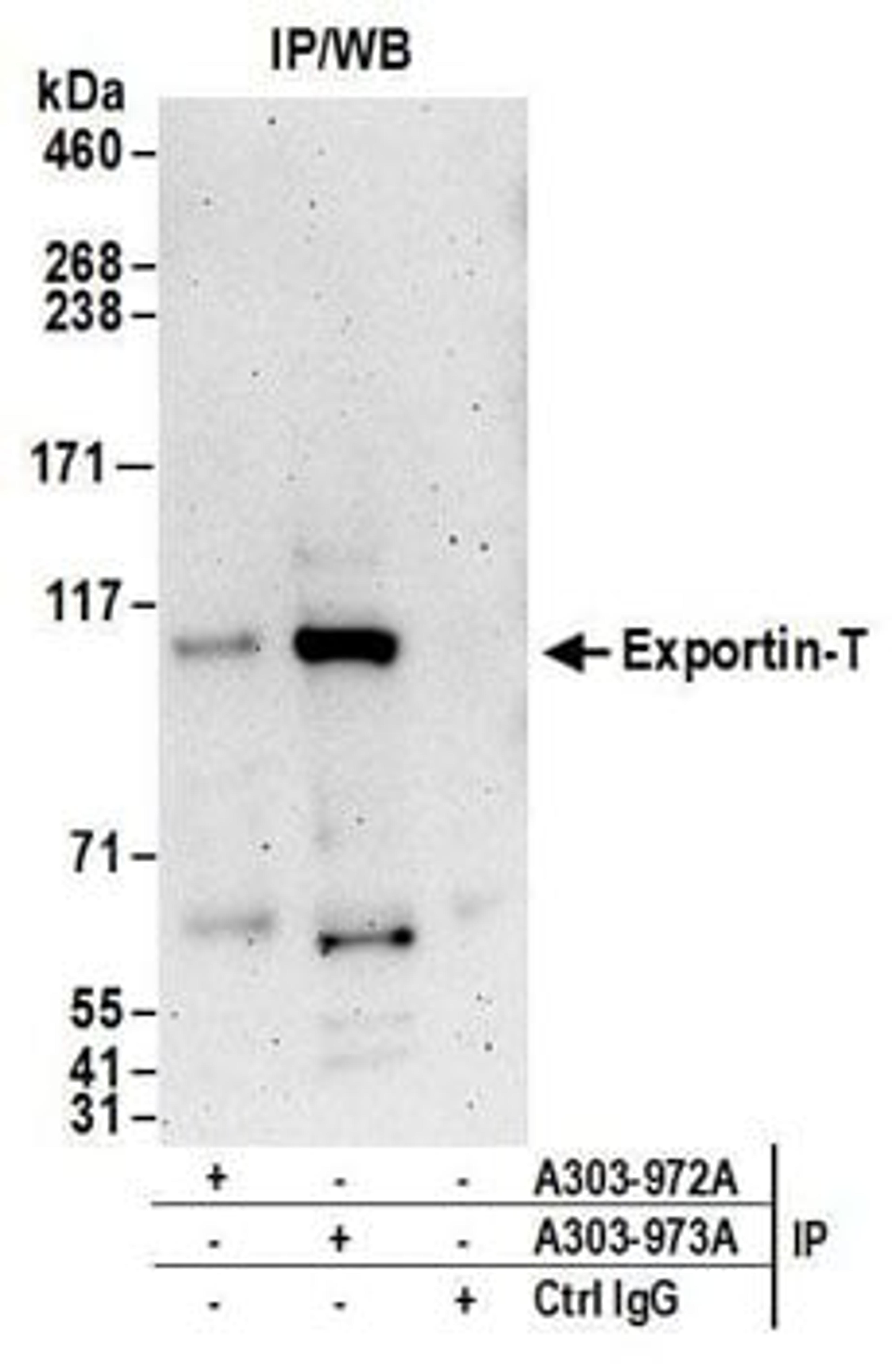 Detection of human Exportin-T by western blot of immunoprecipitates.