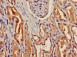 Immunohistochemistry of paraffin-embedded human kidney tissue using CSB-PA530450LA01HU at dilution of 1:100