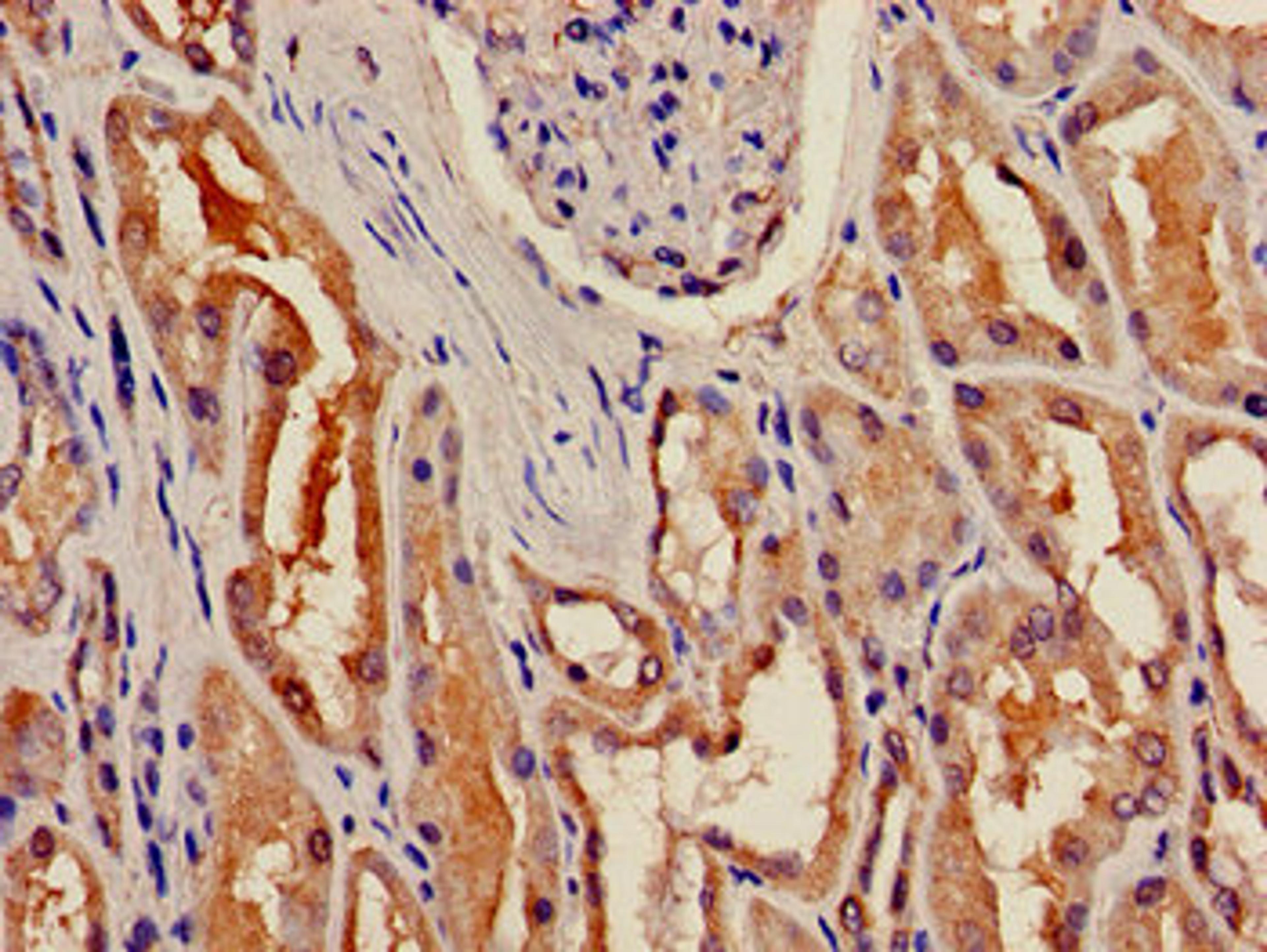 Immunohistochemistry of paraffin-embedded human kidney tissue using CSB-PA530450LA01HU at dilution of 1:100