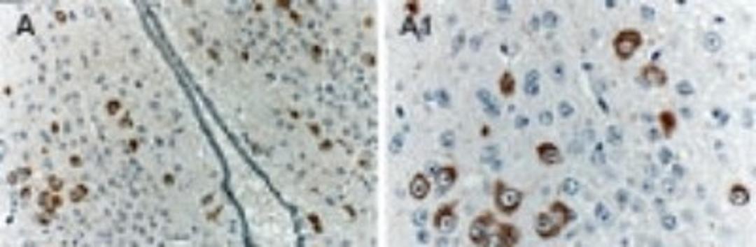 Immunohistochemistry-Paraffin: Bag1 Antibody [NB100-56082] - Formalin-fixed, paraffin-embedded mouse ischemic brain stained for BAG-1 expression using NB100-56082 at 1:2000. A1 is a higher magnification of A.  Differential Bag1 expression levels are seen in the hypothalmic nuclei. The variation in expression levels from lack of Bag1 staining to strong staining may be linked to differential responses of the hypothalmic nuclei to ischemic stress.  Hematoxylin-eosin counterstain.