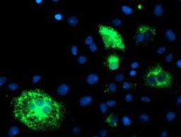 Immunocytochemistry/Immunofluorescence: DHFRL1 Antibody (1E2) [NBP2-01019] - Staining of COS7 cells transiently transfected by pCMV6-ENTRY DHFRL1.