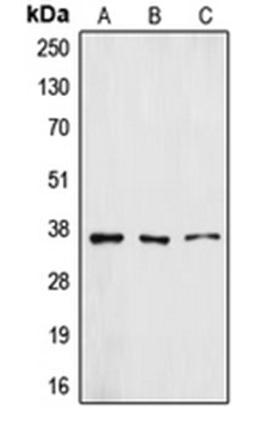 Western blot analysis of A431 (Lane 1), HuvEc (Lane 2), A549 (Lane 3) whole cell lysates using ZFP36L1 antibody