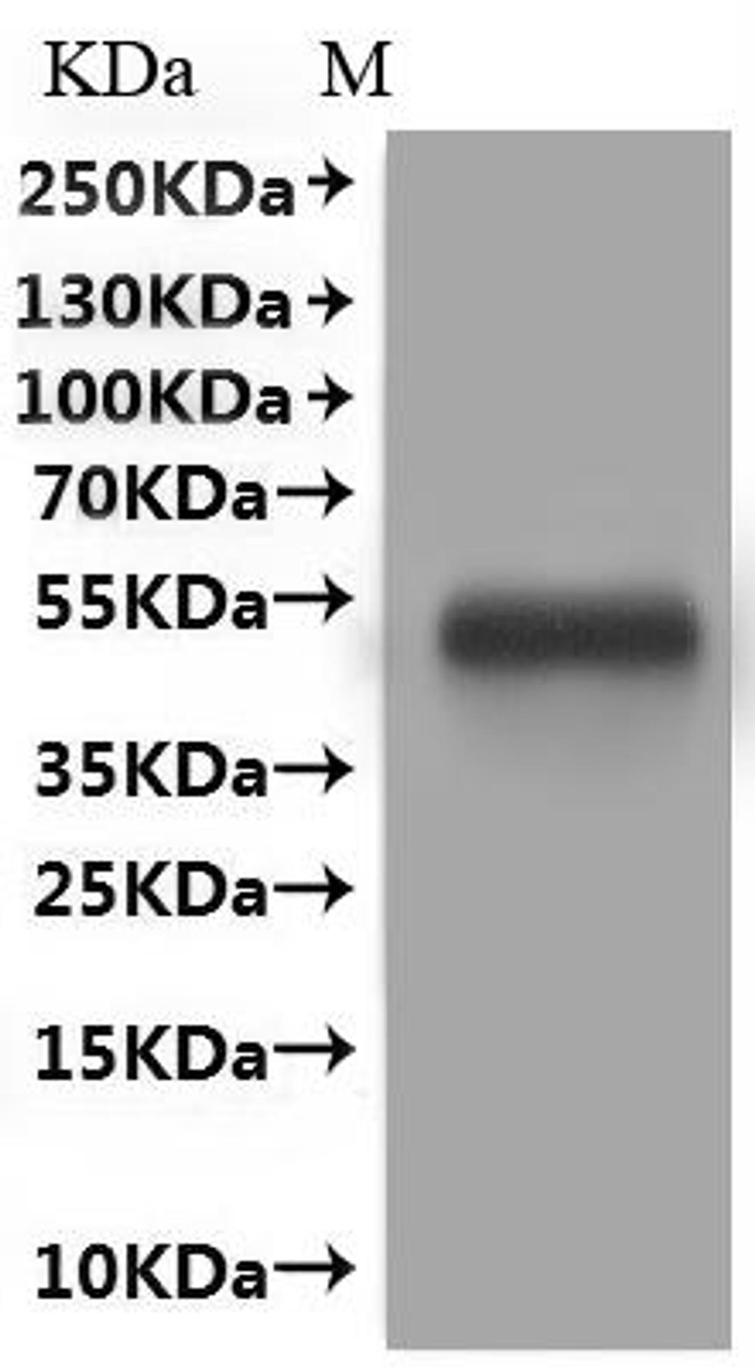 CSB-MP619083HU(A4)is detected by Mouse anti-GFP monoclonal antibody.