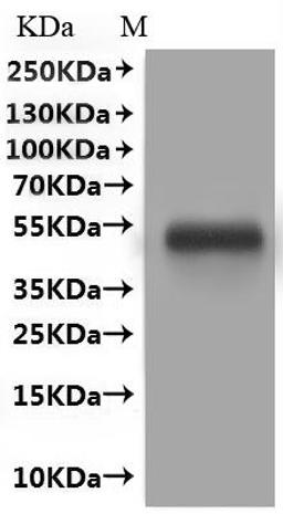 CSB-MP619083HU(A4)is detected by Mouse anti-GFP monoclonal antibody.