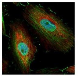 Immunocytochemistry/Immunofluorescence: BIVM Antibody [NBP1-31214] - Paraformaldehyde-fixed HeLa, using BIVM antibody (Green) at 1:500 dilution. Alpha-tubulin filaments were labeled with an alpha Tubulin antibody (Red) at 1:2000.