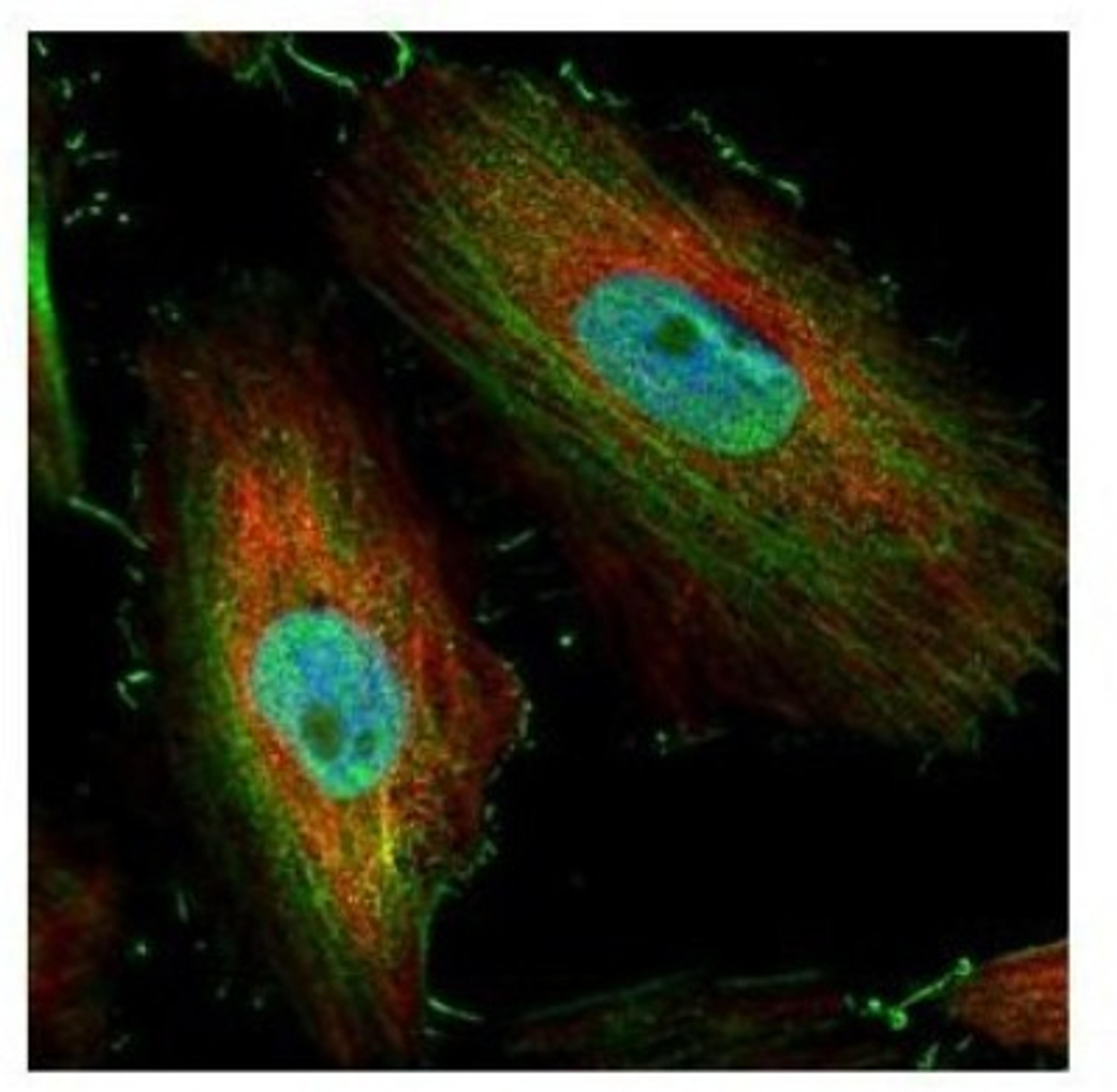 Immunocytochemistry/Immunofluorescence: BIVM Antibody [NBP1-31214] - Paraformaldehyde-fixed HeLa, using BIVM antibody (Green) at 1:500 dilution. Alpha-tubulin filaments were labeled with an alpha Tubulin antibody (Red) at 1:2000.