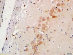 Immunohistochemical staining of rat brain tissue using NKCC1 antibody.