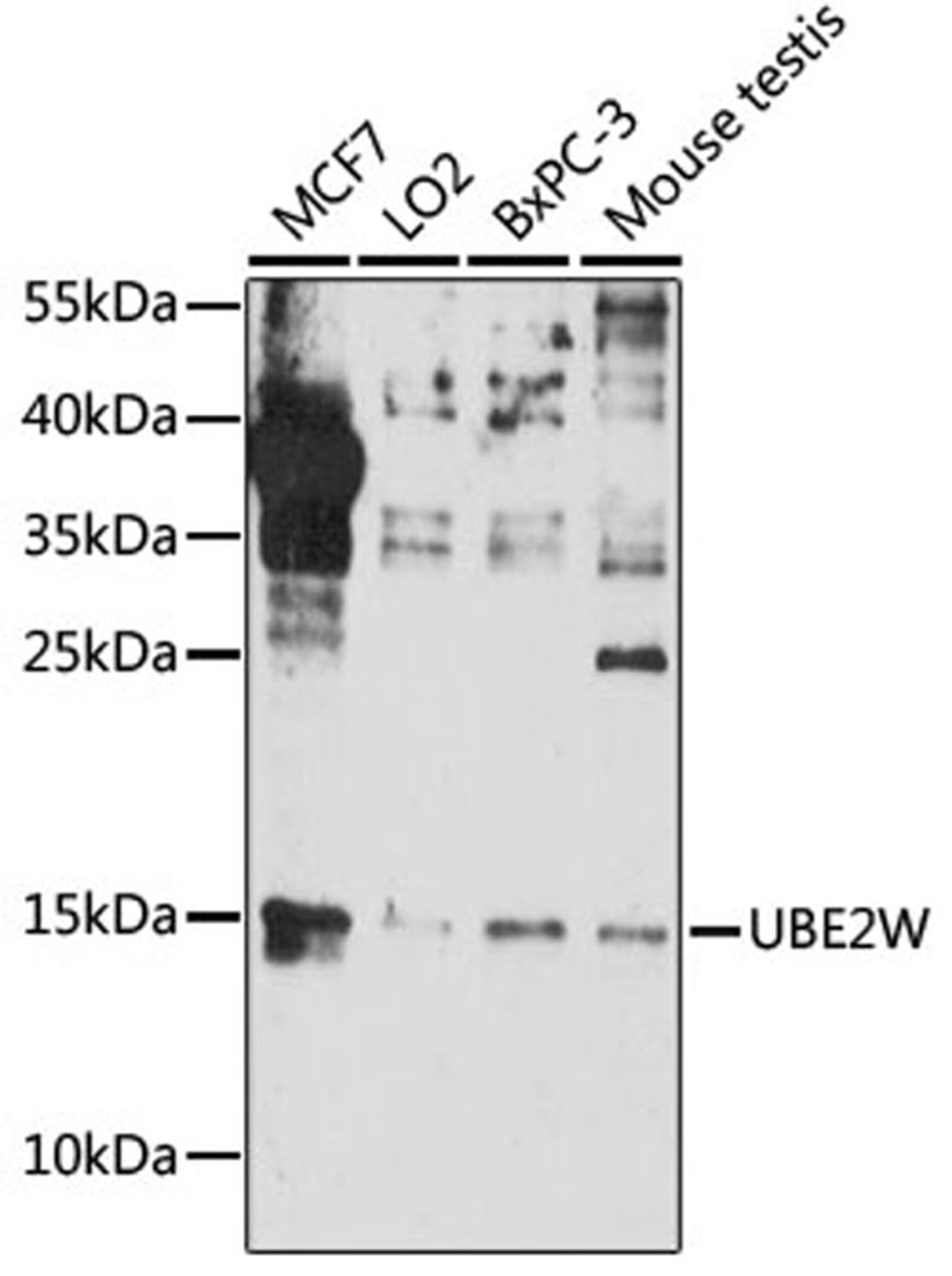 Western blot - UBE2W antibody (A16691)