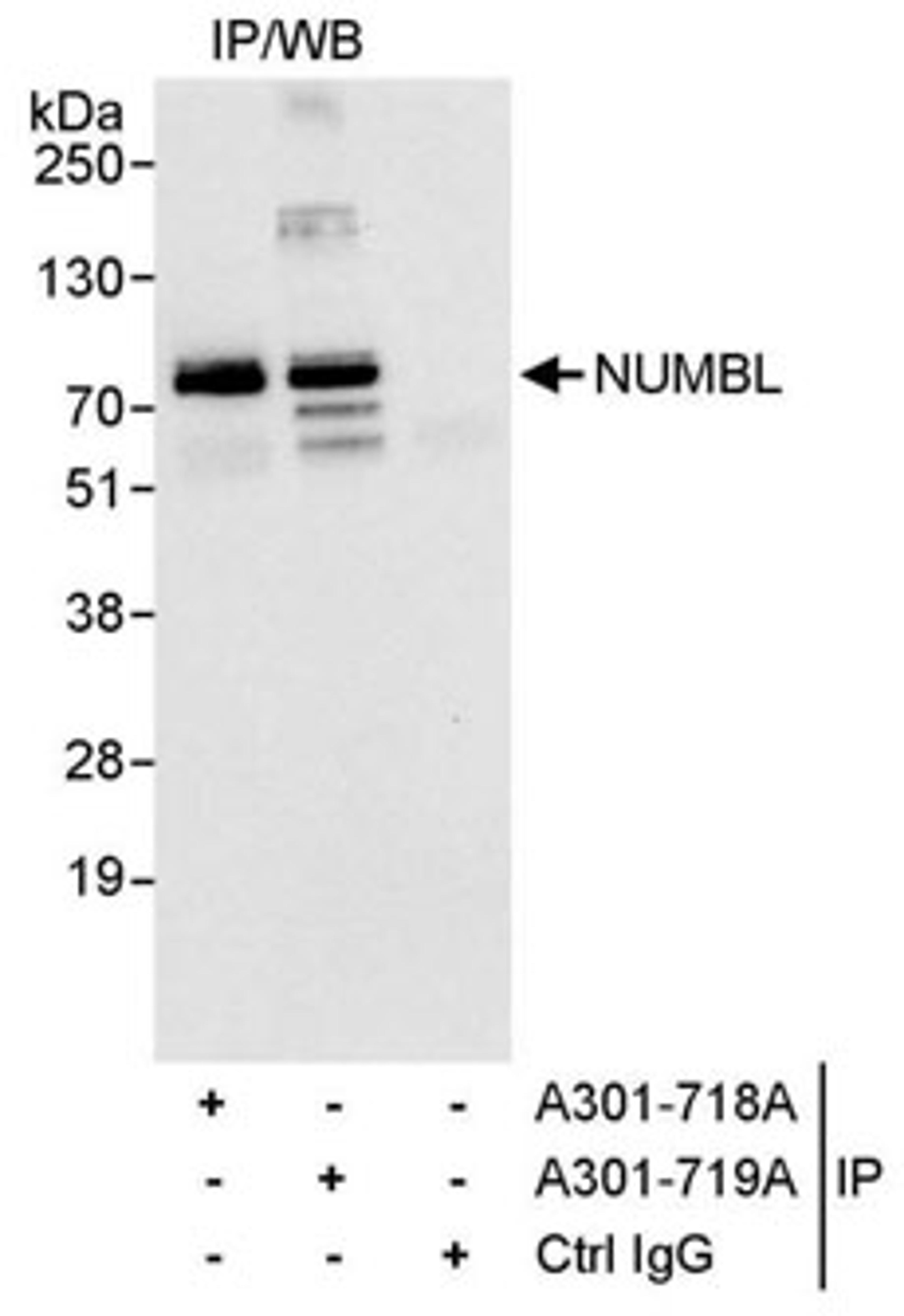 Detection of human NUMBL1 by western blot of immunoprecipitates.