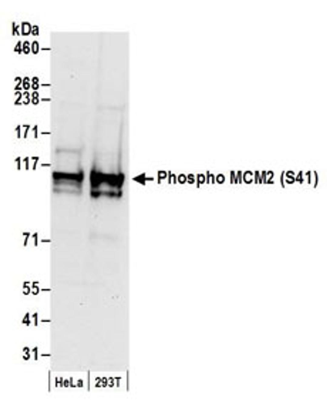 Detection of human Phospho MCM2 (S41) by western blot.