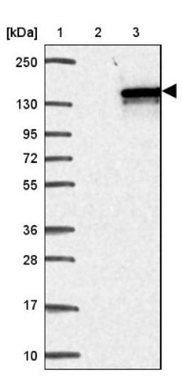 Western Blot: CDAN1 Antibody [NBP2-38473] - Lane 1: Marker [kDa] 250, 130, 95, 72, 55, 36, 28, 17, 10<br/>Lane 2: Negative Control<br/>Lane 3: LY408581