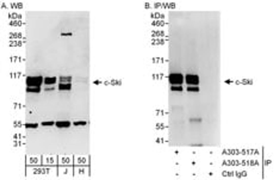 Detection of human c-Ski by western blot and immunoprecipitation.